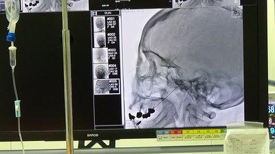 藤田医科大学ばんたね病院 麻酔科専門医研修プログラム